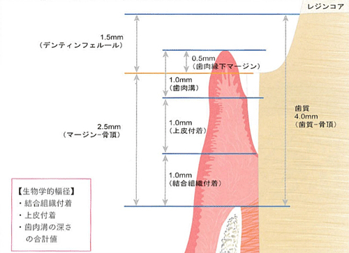 Biolgic width 01